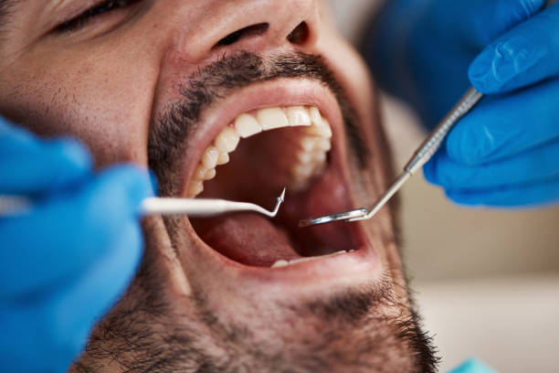 Best Emergency Dental Surgery in Central City, PA